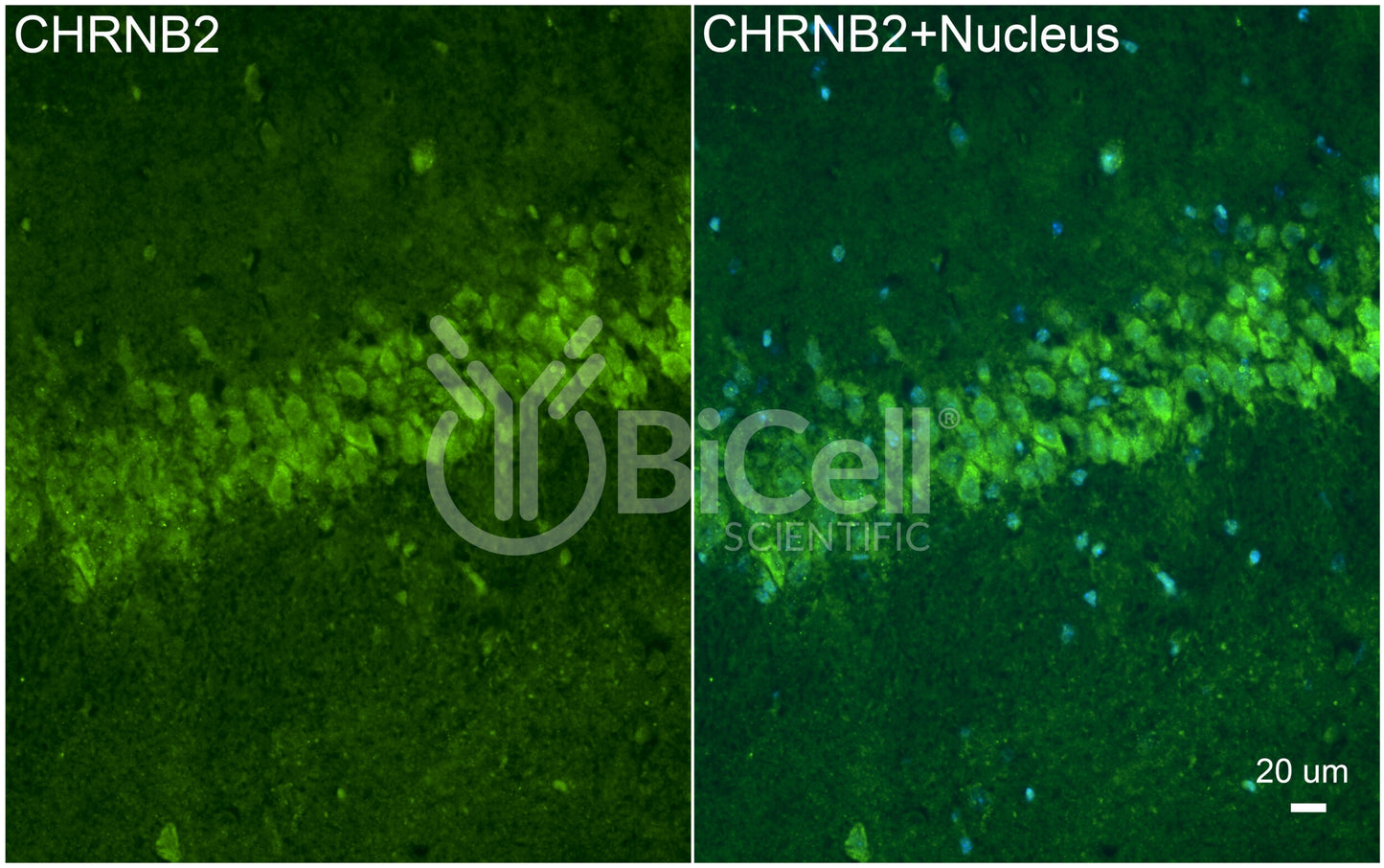 CHRNB2 (nAChRB2) Antibody