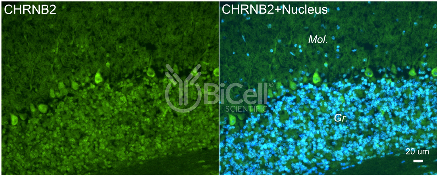 CHRNB2 (nAChRB2) Antibody