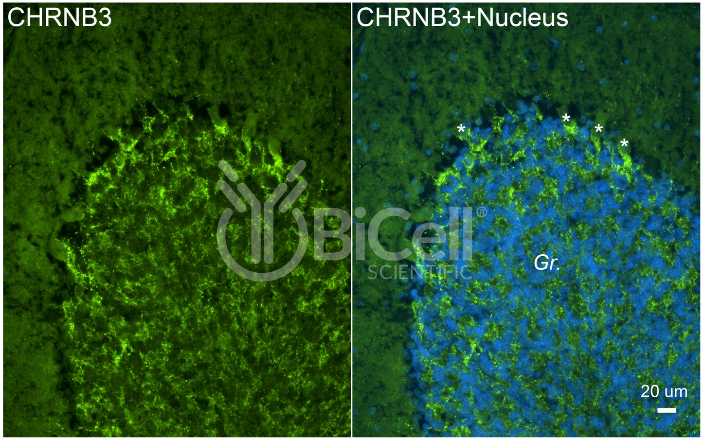CHRNB3 Antibody