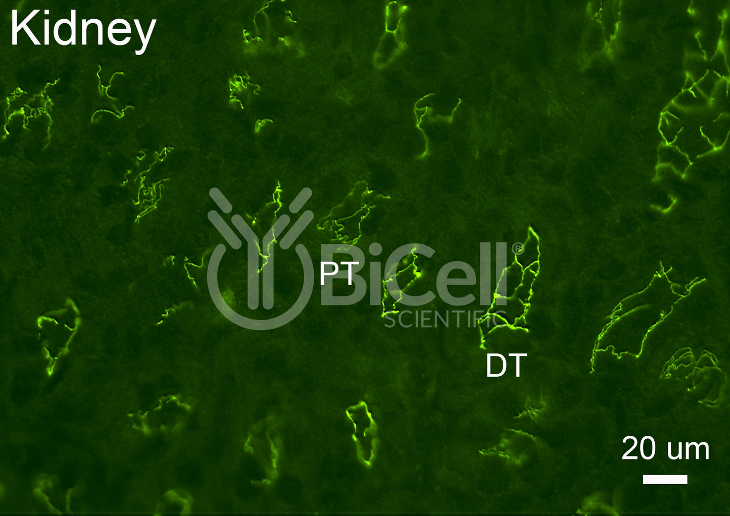 Cingulin (CGN) Antibody