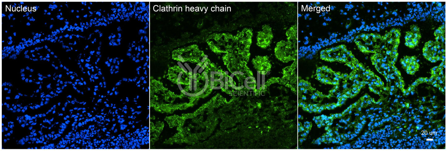 Clathrin Heavy Chain (CLTC) HiRe Antibody
