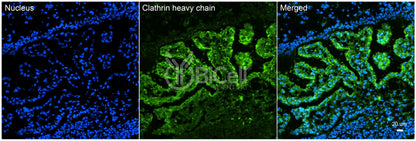 Clathrin Heavy Chain (CLTC) HiRe Antibody