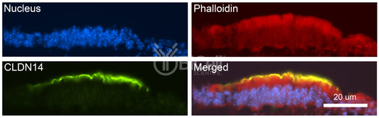 Claudin-14 (CLDN14) Antibody