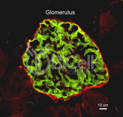 Claudin-1 (CLDN1) Antibody - FFPE Validated