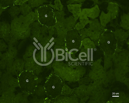 Claudin-1 (CLDN1) Antibody - FFPE Validated