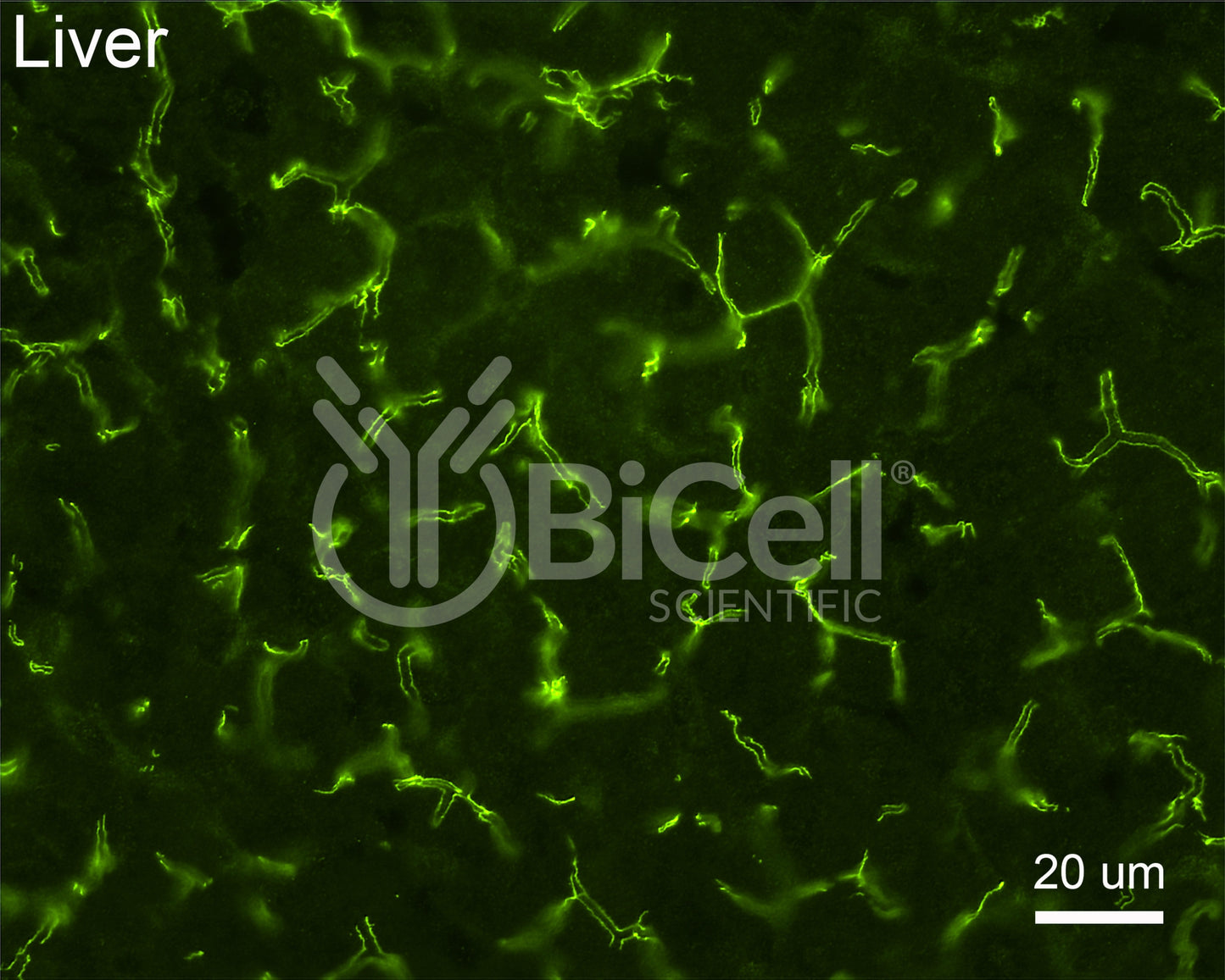 Claudin-1 (CLDN1) Antibody - FFPE Validated