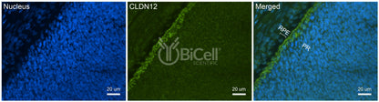 Claudin-12 (CLDN12) Antibody
