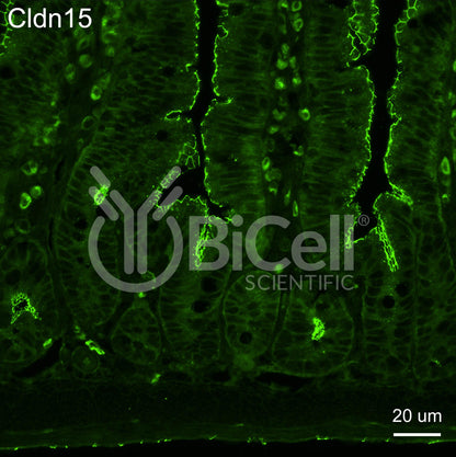 Claudin-15 (CLDN15) Monoclonal Antibody (A10 Clone)