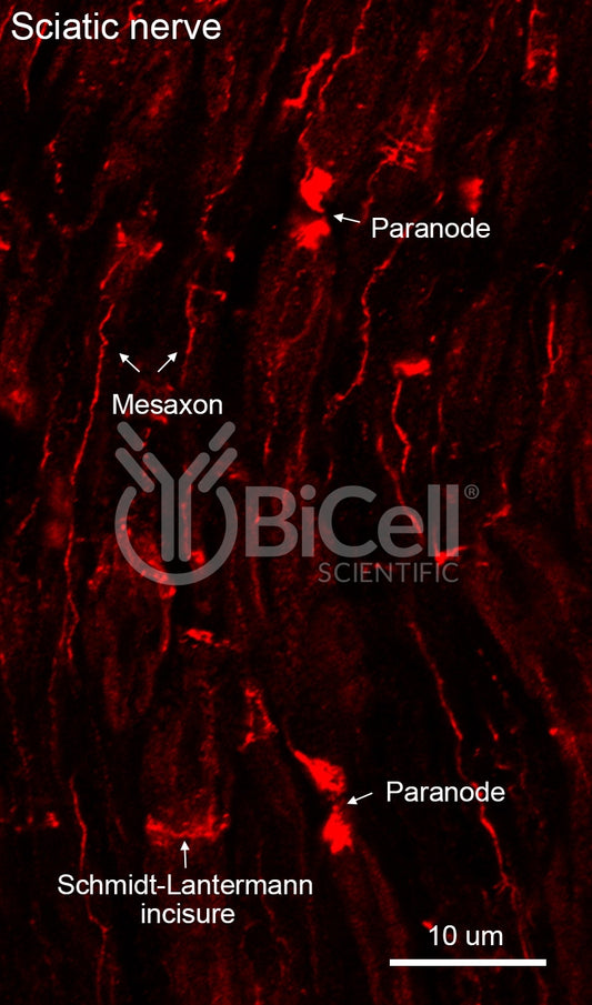 Claudin-19 (CLDN19) Antibody