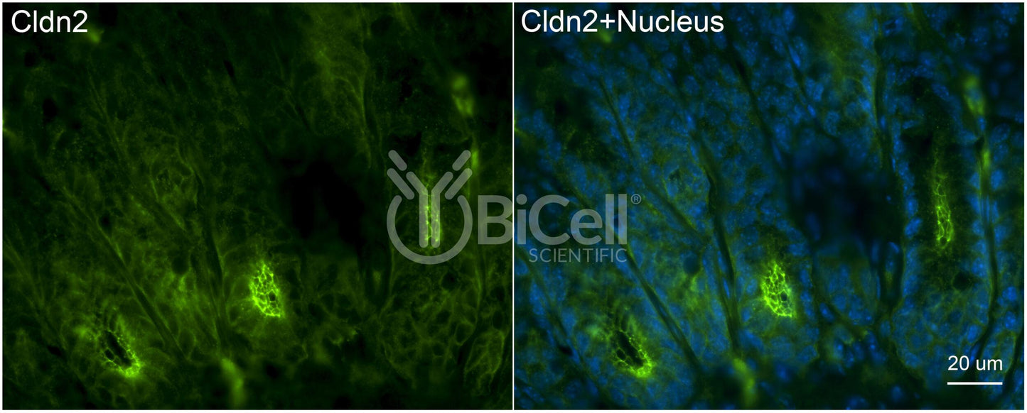 Claudin-2 (CLDN2) Monoclonal Antibody (G2 Clone) - FFPE Validated