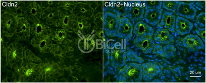 Claudin-2 (CLDN2) Monoclonal Antibody (G2 Clone) - FFPE Validated