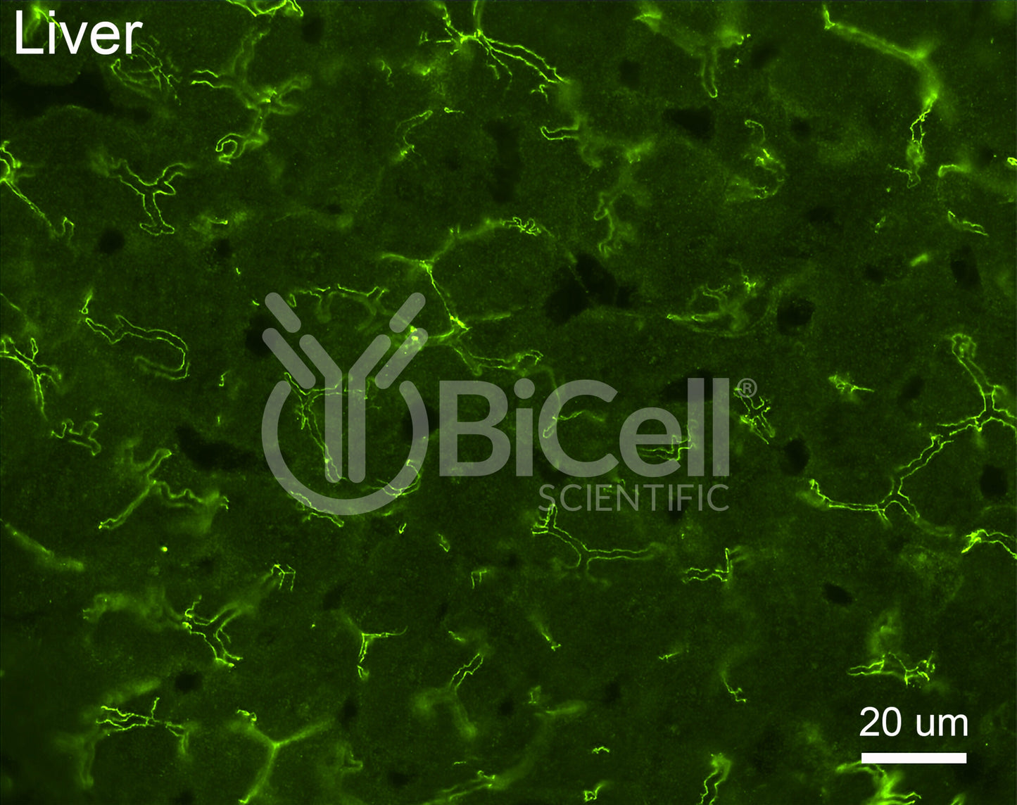 Claudin-2 (CLDN2) Antibody - Western Blot Validated