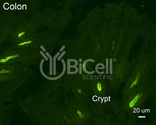 Claudin-2 (CLDN2) Antibody - Western Blot Validated