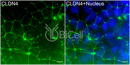 Claudin-4 (CLDN4) Antibody - FFPE Validated