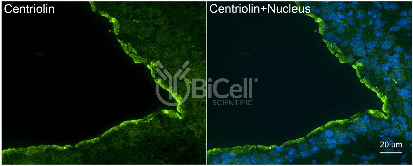 Centriolin (CEP110) Antibody - FFPE Validated