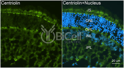 Centriolin (CEP110) Antibody - FFPE Validated