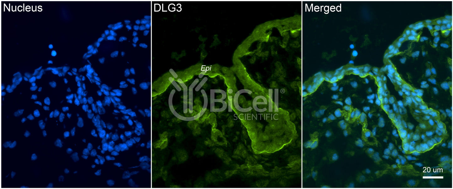 DLG3 (SAP-102 or NEDLG) Antibody - Western Blot Validated