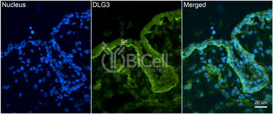 DLG3 (SAP-102 or NEDLG) Antibody