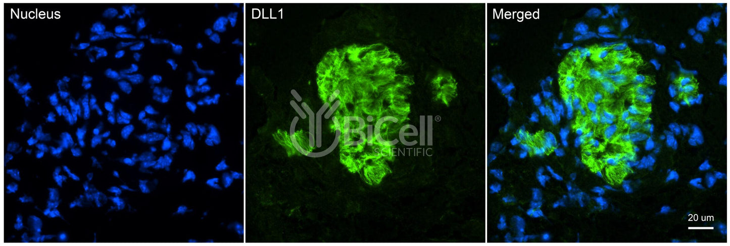 DLL1 (Delta1 or Delta) Antibody - Western Blot Validated