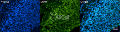 DNMT1 (DNMT) Antibody - Western Blot Validated
