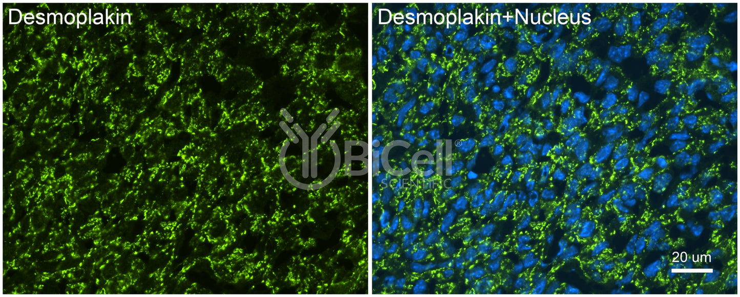 Desmoplakin (DSP) Antibody
