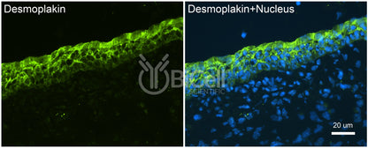 Desmoplakin (DSP) Antibody - FFPE Validated