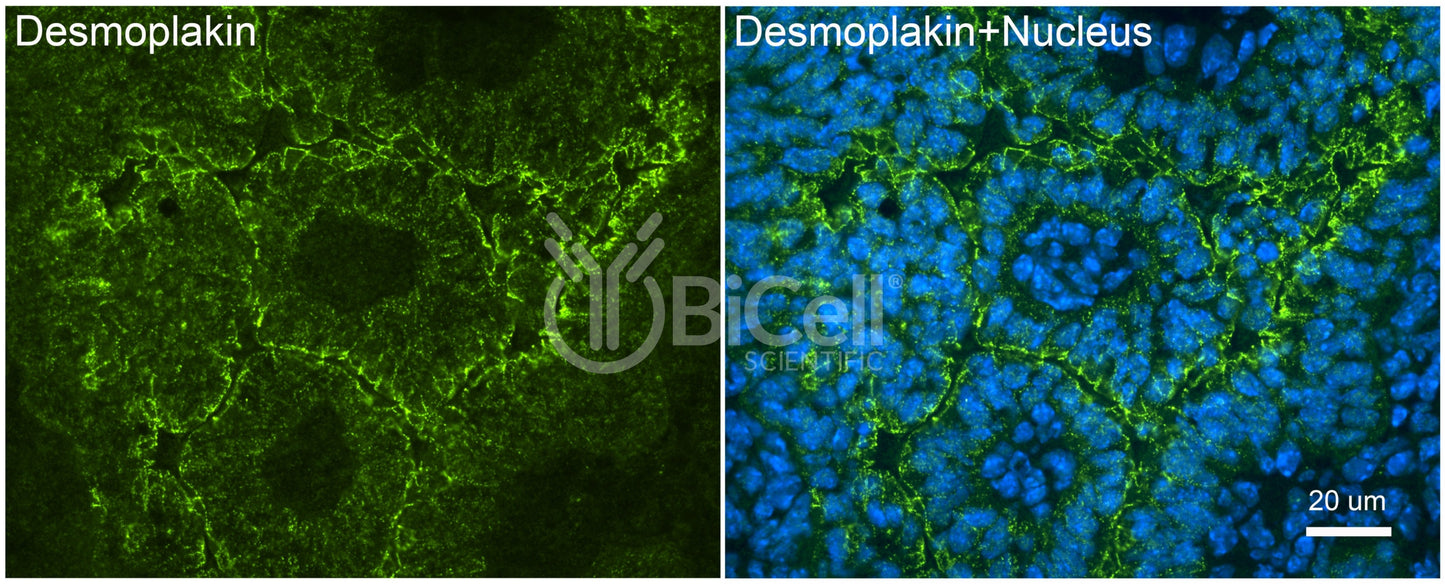 Desmoplakin (DSP) Antibody