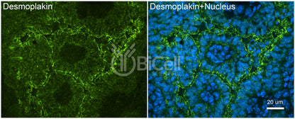 Desmoplakin (DSP) Antibody