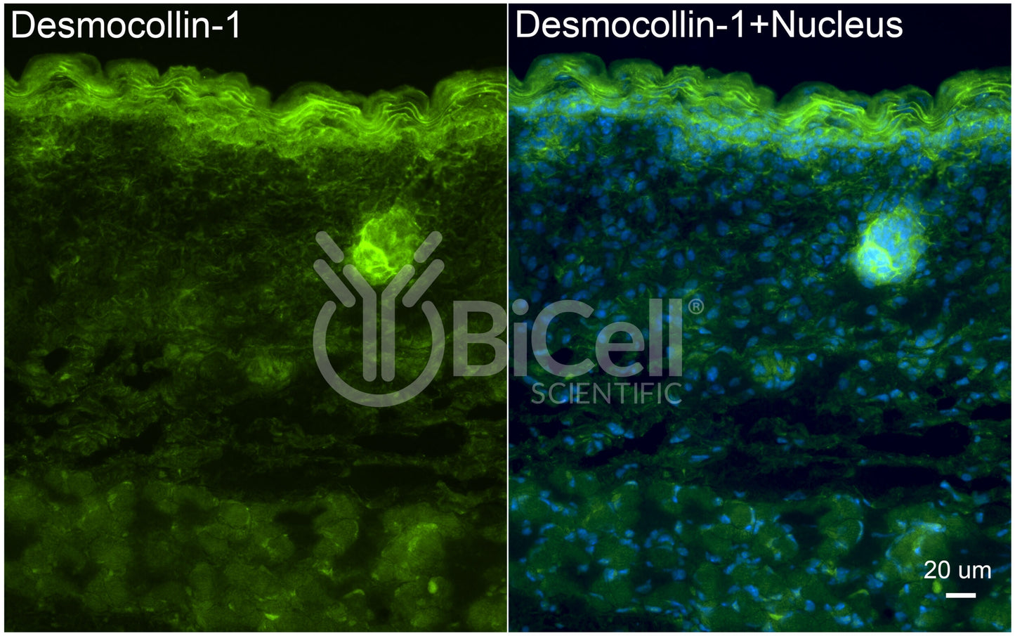 Desmocollin-1 (DSC1) Antibody - Western Blot Validated