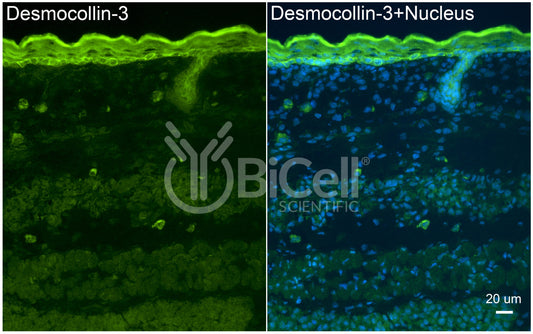Desmocollin-3 (DSC3) Antibody - Western Blot Validated