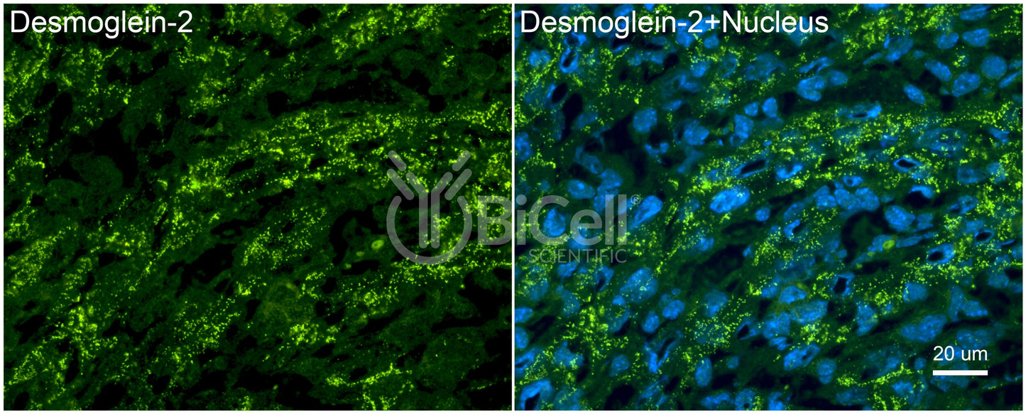 Desmoglein-2 (DSG2) Antibody