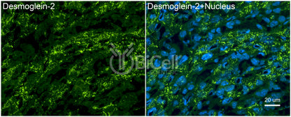Desmoglein-2 (DSG2) Antibody