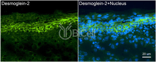 Desmoglein-2 (DSG2) Antibody - Western Blot Validated