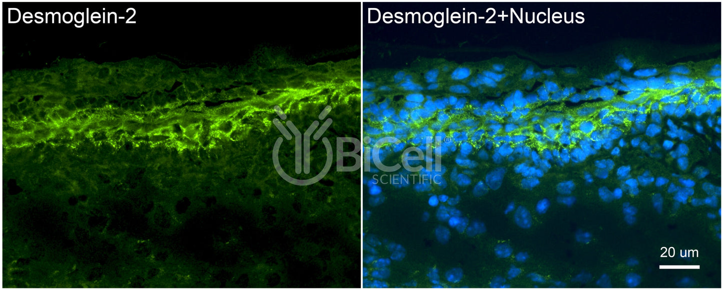 Desmoglein-2 (DSG2) Antibody