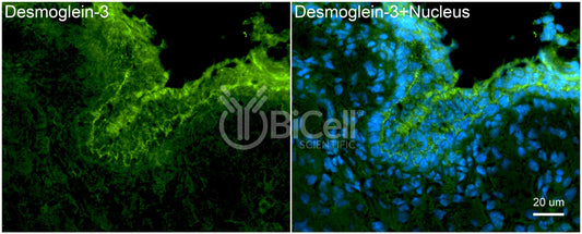 Desmoglein-3 (DSG3) Antibody