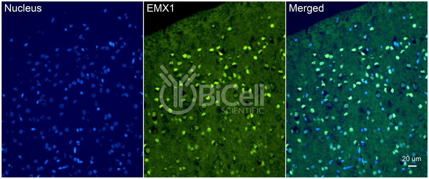 EMX1 Antibody - FFPE Validated