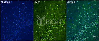 EMX1 Antibody - FFPE Validated