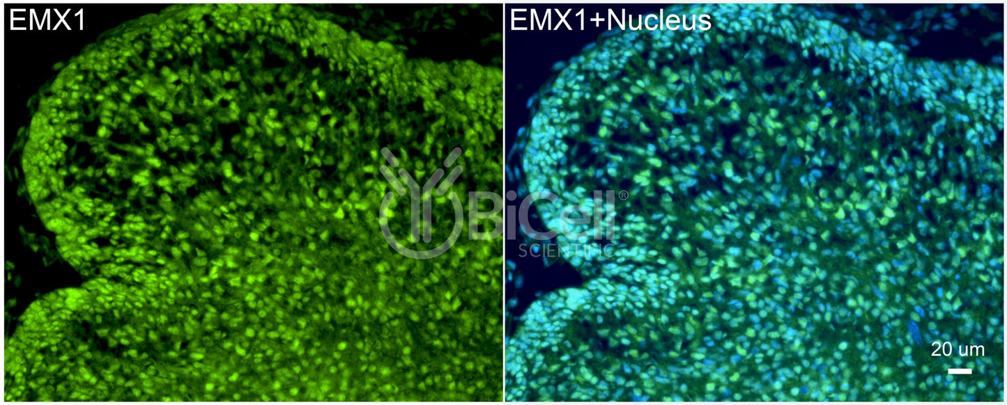 EMX1 Antibody - FFPE Validated
