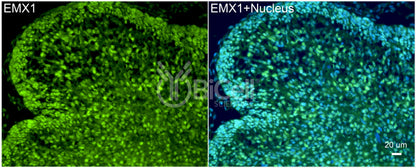EMX1 Antibody - FFPE Validated