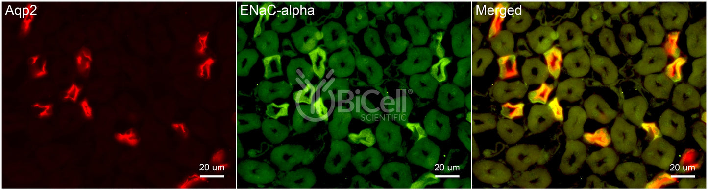 ENaC alpha (Scnn1a) Antibody - FFPE Validated