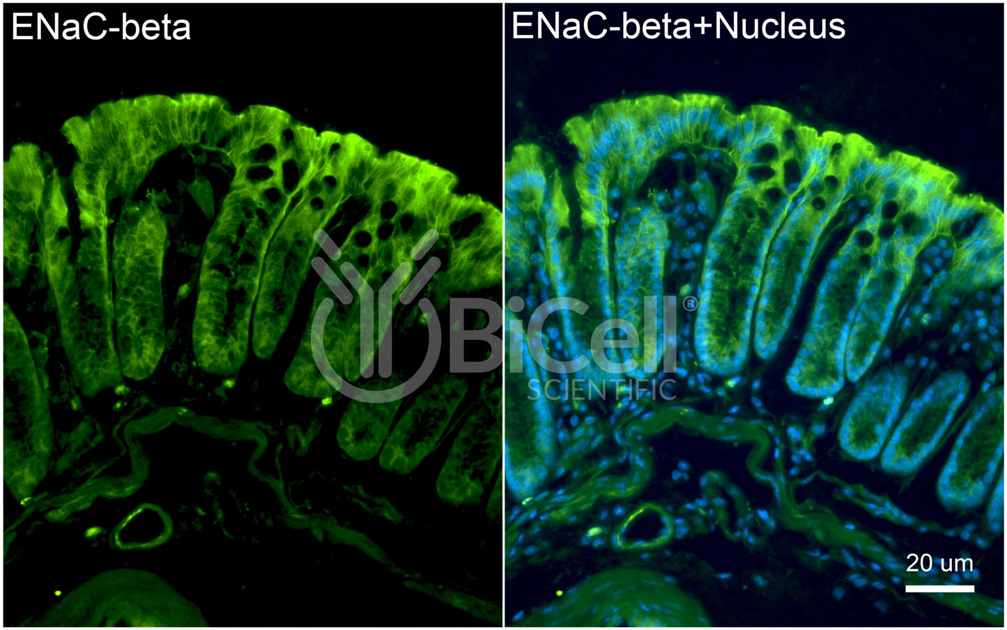 ENaC beta (Scnn1b) Antibody