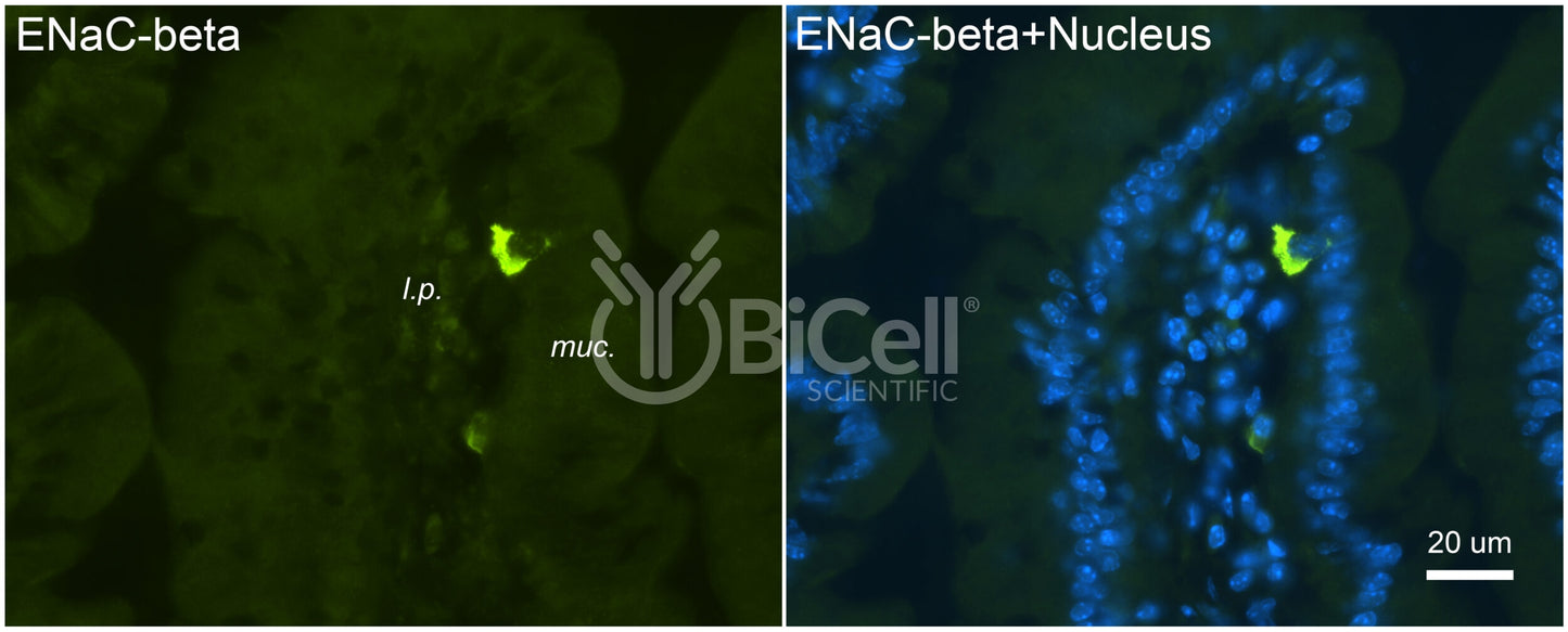 ENaC beta (Scnn1b) Antibody