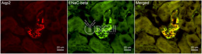 ENaC beta (Scnn1b) Antibody