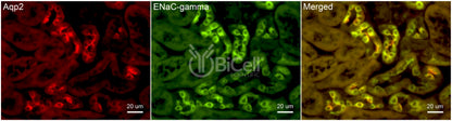 ENaC gamma (Scnn1g) Antibody - Western Blot Validated