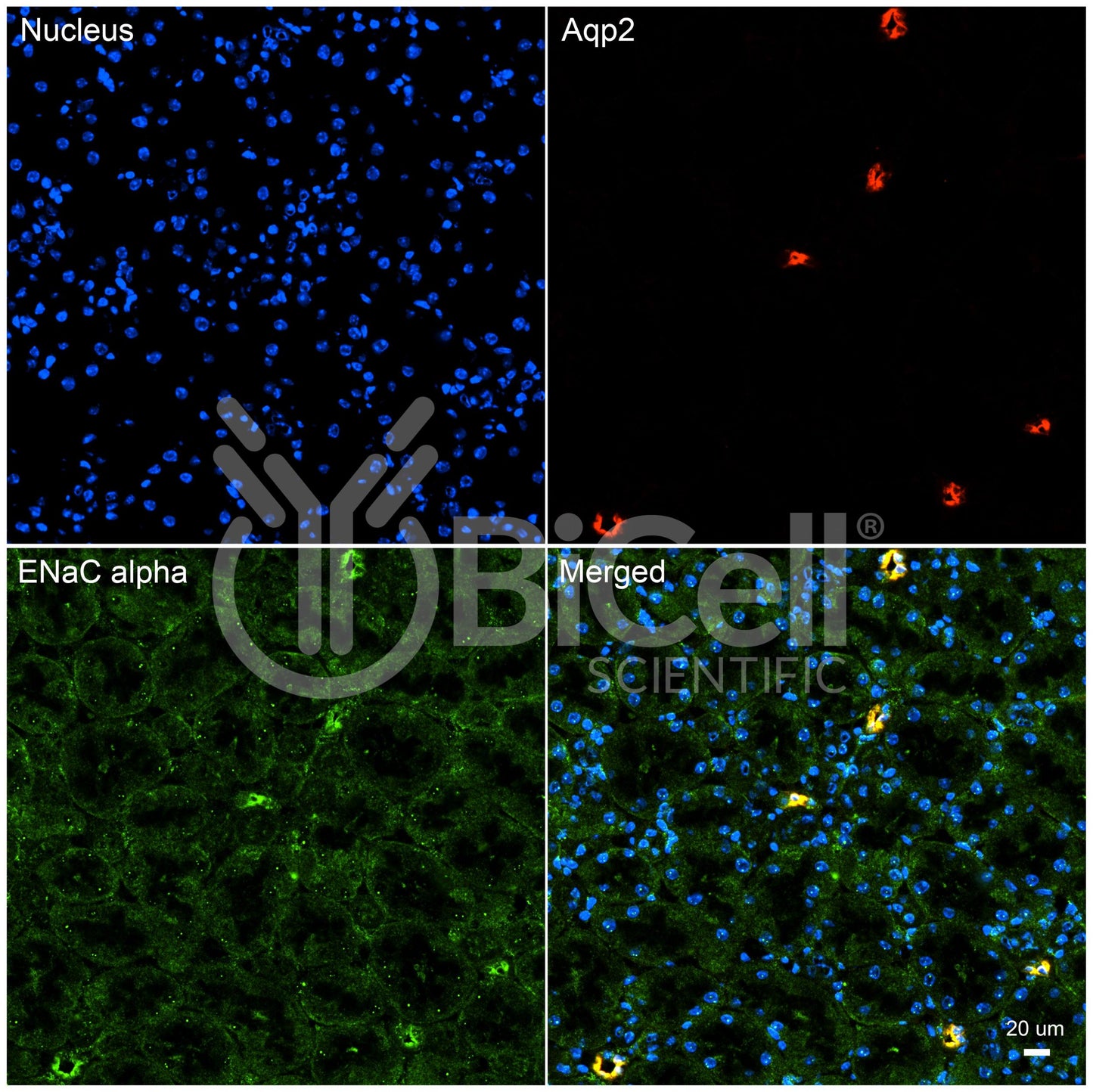 ENaC alpha (Scnn1a) (N-Terminus) Antibody - Western Blot Validated