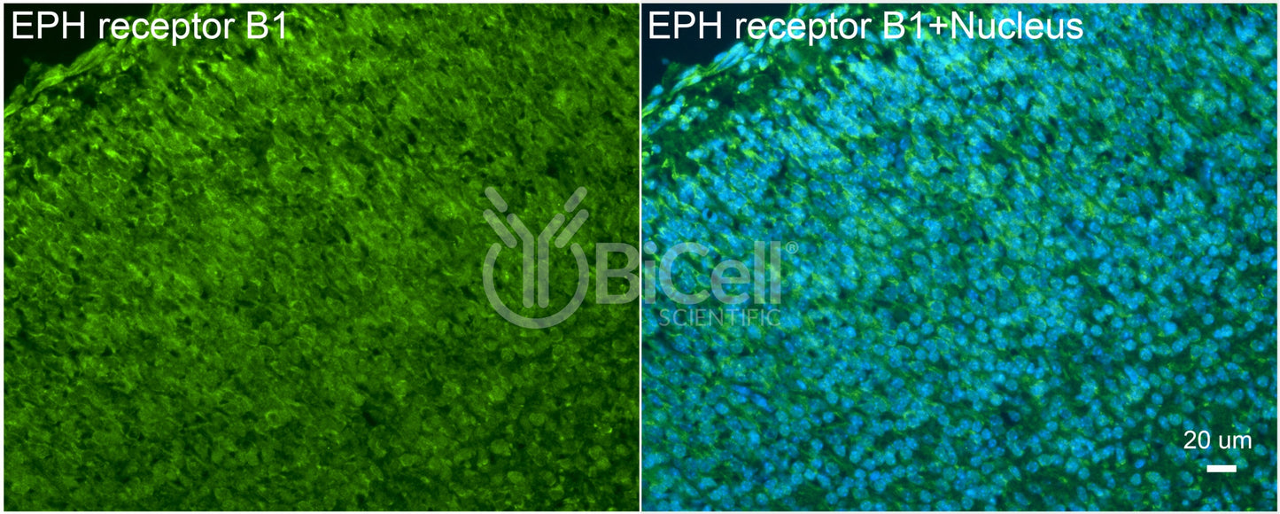 EPH receptor B1 (EPHB1) Antibody - FFPE Validated