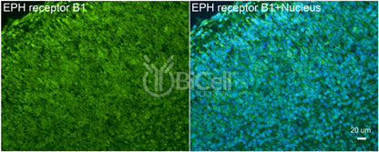 EPH receptor B1 (EPHB1) Antibody - FFPE Validated