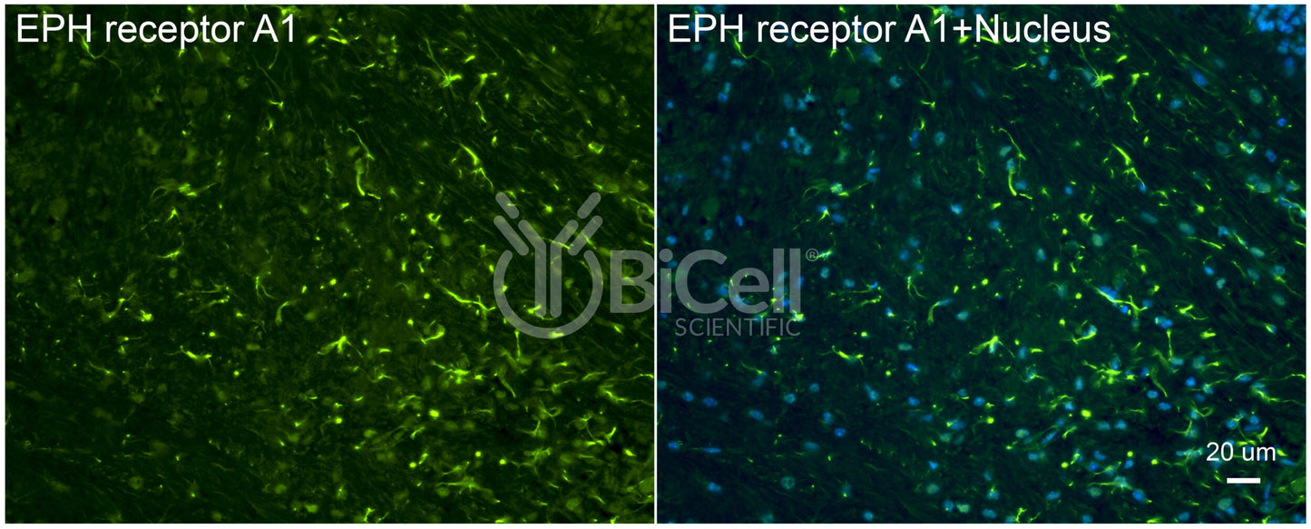 EPH receptor A1 (EPHA1) Antibody