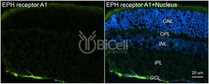 EPH receptor A1 (EPHA1) Antibody