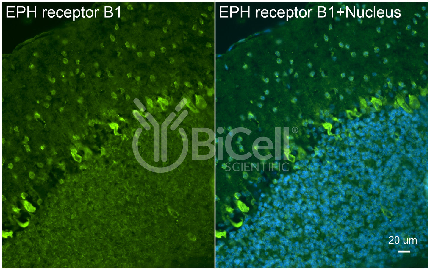 EPH receptor B1 (EPHB1) Antibody